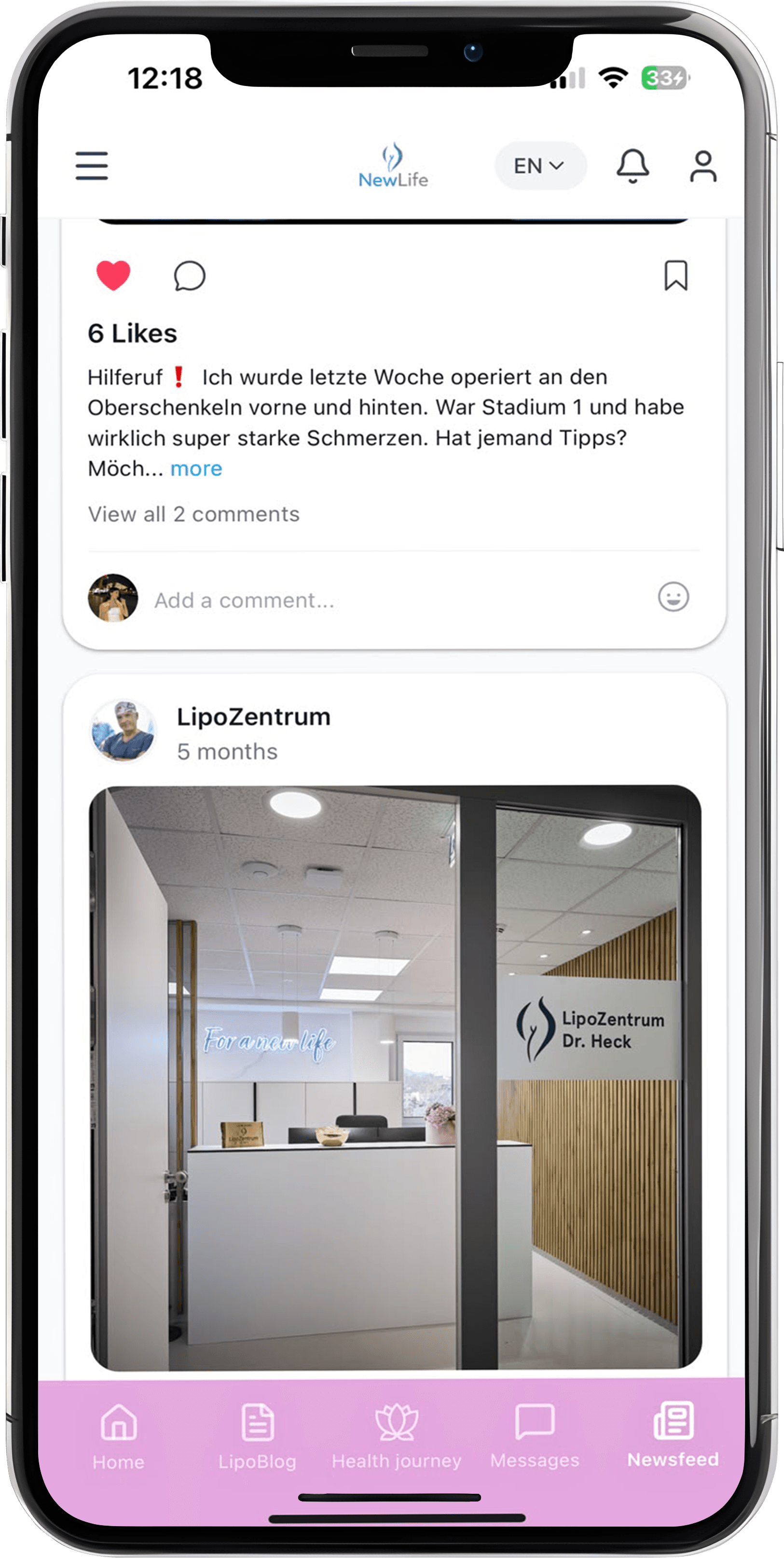 Community-Feed